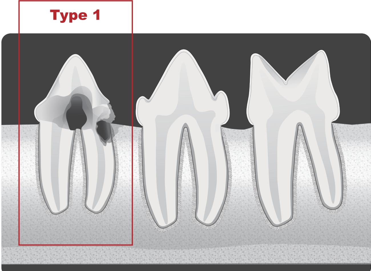 Avdc Dental Chart